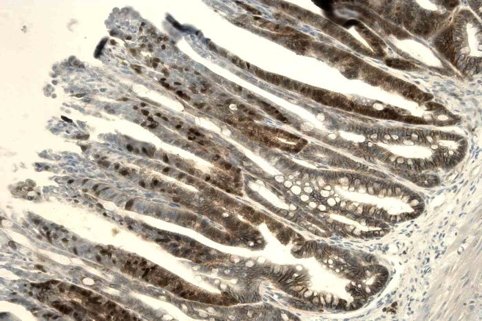 β-catenin immunohistochemistry staining of the mouse colon