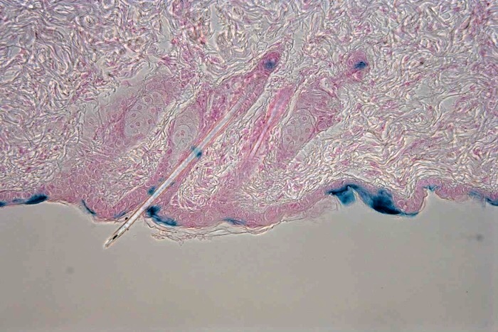 lacZ staining of the transgenic mouse hair follicles contrastained with Nuclear Fast Red