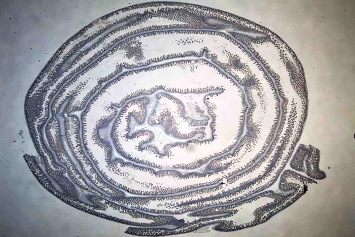 β-catenin immunohistochemistry staining of the whole mouse intestine