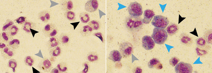Cell morphological analysis assessed on May-Grunwald Giemsa stained cytospins