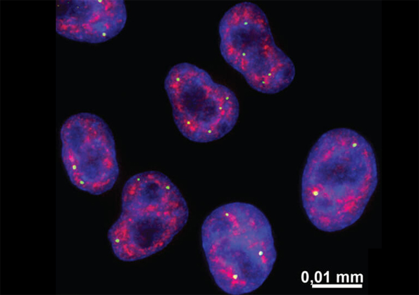 Localization of one of the spliceosomal particles (red) in a human carcinoma cell line.