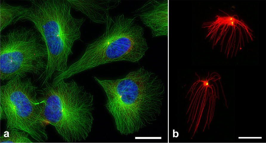 Nukleace mikrotubulů z centrozómů v buňkách a in vitro.