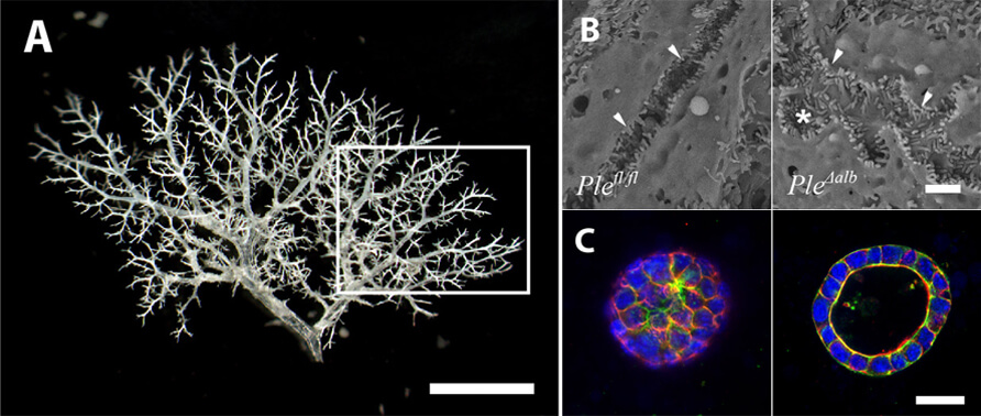 Visualization of biliary tree architecture.