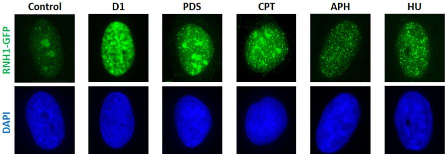 Replication stress induces R-loop formation in the cell nucleus. Expression of marker protein RNase H1(D210N)-GFP was induced by doxycycline (DOX) and cells were exposed to various sources of replication stress: diospyrin D1 (D1), pyridostatin (PDS), campthotecin (CPT), hydroxyurea (HU), and aphidicolin (APH). Cells were pre-extracted and accumulation of chromatin-bound RNaseH1(D210N)-GFP was visualized by microscopy.