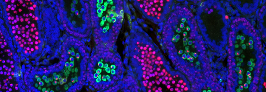 Cross-sections of 22-day-old rat testes with labelled DNA (blue), a nuclear protein of less advanced sperm precursors (red), and a cytoplasmic protein of more advanced sperm precursors (green) visualized by fluorescence microscopy. Comparing sections from control and mutant testes revealed delayed meiotic progression in mutant males.