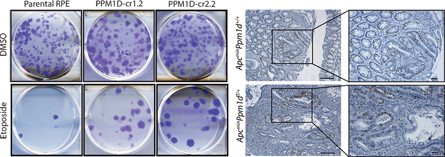 Onkogenní vlastnosti zkrácené alely PPM1D/WIP1. Kontrolní buňky a buňky nesoucí zkrácenou alelu PPM1D (cr1.2 a cr2.2) byly ošetřeny vehikulem nebo etoposidem a přežití buněk bylo hodnoceno testem tvorby kolonií (vlevo). Transgenní myši nesoucí zkrácenou alelu Ppm1d T/+vykazují zrychlenou progresi rakoviny tlustého střeva vyvolanou Apc min(vpravo).