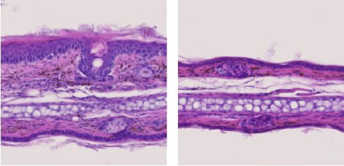 Histologická analýza uší laboratorních myší trpících autoimunitní lupénkou. 