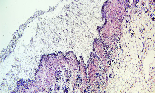 Kožní štěpy myši porostlé dermatofitními houbami (Hematoxylin a eosin barvení)