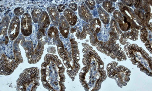 Imunohistochemické barvení β-kateninu (hnědé) ve střevě myši, buněčná jádra kontrastovaná hematoxylinem (modrofialová)