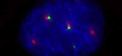 Localization of Gemin3 in the nucleus of a human cell. Gemin3 in green, Cajal bodies in red and DNA in blue. Source: Adriana Roithová, Institute of Molecular Genetics of the Czech Academy of Sciences.