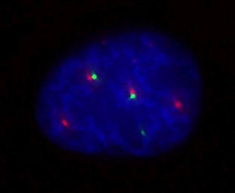 Localization of Gemin3 in the nucleus of a human cell. Gemin3 in green, Cajal bodies in red and DNA in blue. Source: Adriana Roithová, Institute of Molecular Genetics of the Czech Academy of Sciences.