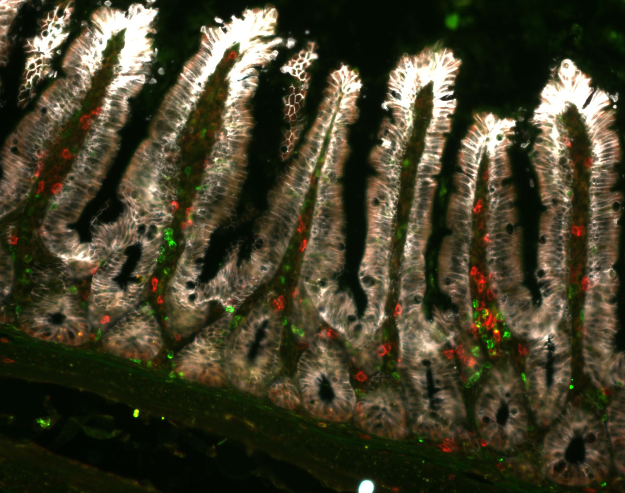 Immune response to SFB bacteria in intestine. Photo: Katarína Kováčová