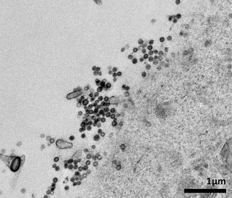 An electron microscope photo shows a part of a cell producing tetherin. Tetherin-bound retroviral particles are visible on the cell surface.