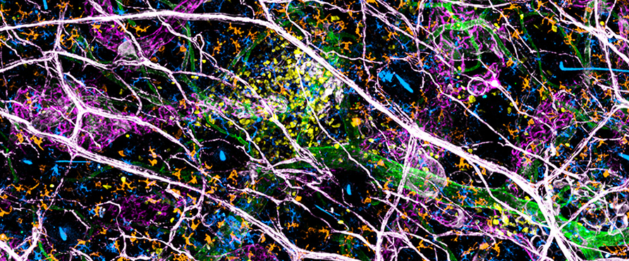 Cluster of OT-I GFP cells (yellow) in the skin of MVA-OVA-infected mice. 
