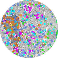 Open House of IMG - Electron Microscopy