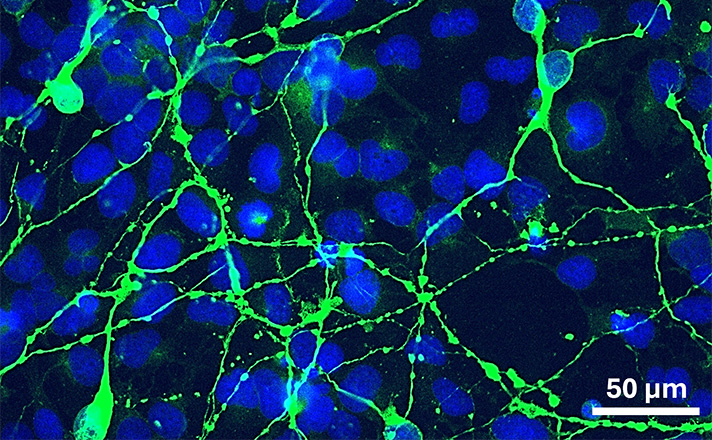 Neurální progenitory vytvořené z pacientských buněk s mutací v genu BRAT1 slouží jako model pro studium vzácných neurovývojových onemocnění.