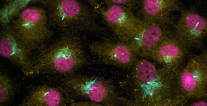 Immunofluorescence image of RPE1 cells. Acetylated tubulin marking primary cilia (cyan), K63-linked ubiquitin (yellow), and cell nuclei (magenta).