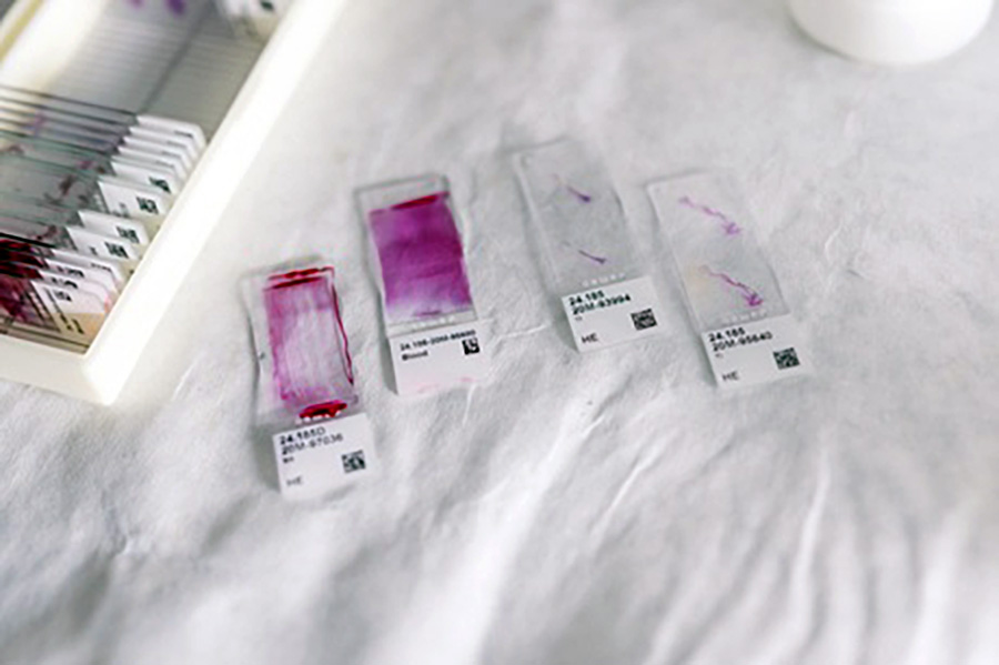 vzorky krve - Laboratoř buněčné a vývojové biologie